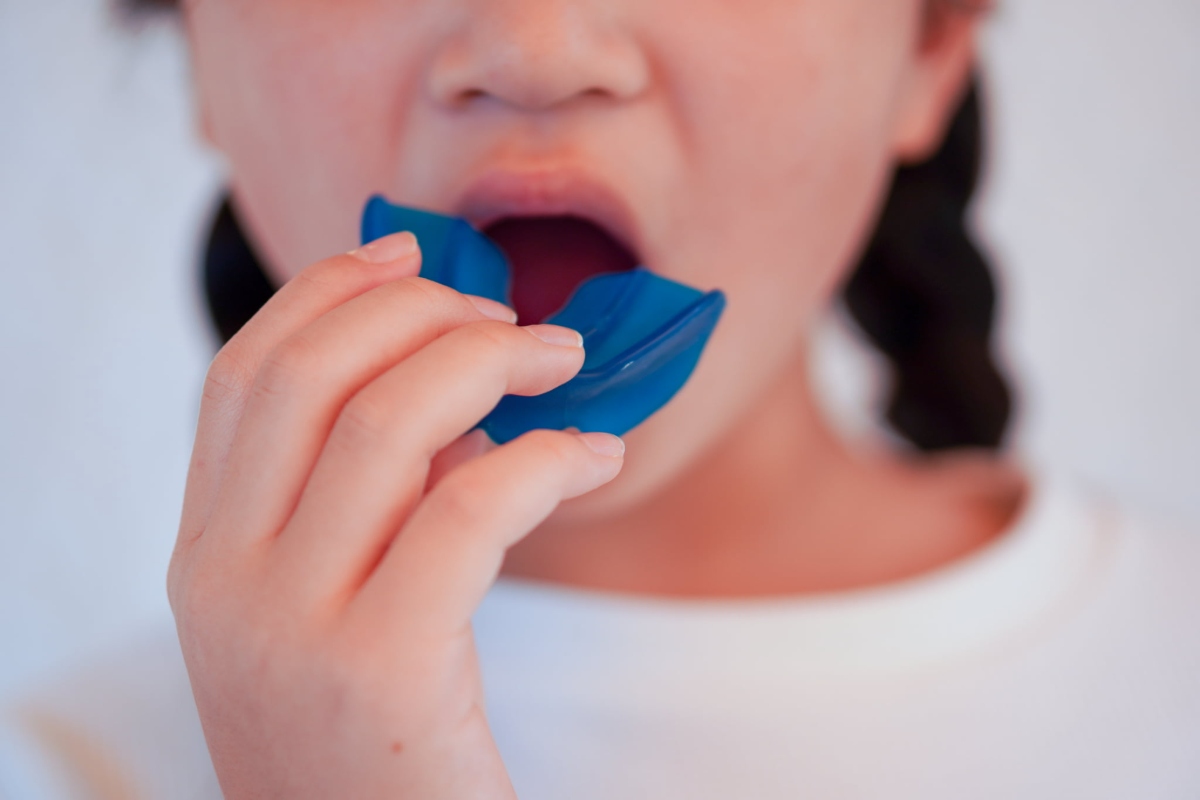 プレオルソを装着しようとしている子どもの口元